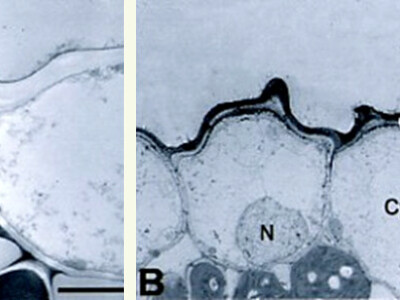 Zaštitnik biljaka od bolesti, insekata i mehaničkog oštećenja ploda