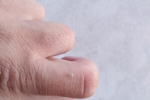 Hrastova mrežasta stenica