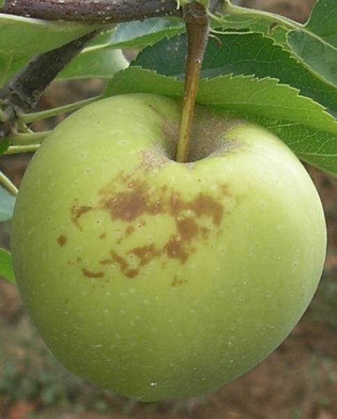 II tip ožegotina - posmeđenja