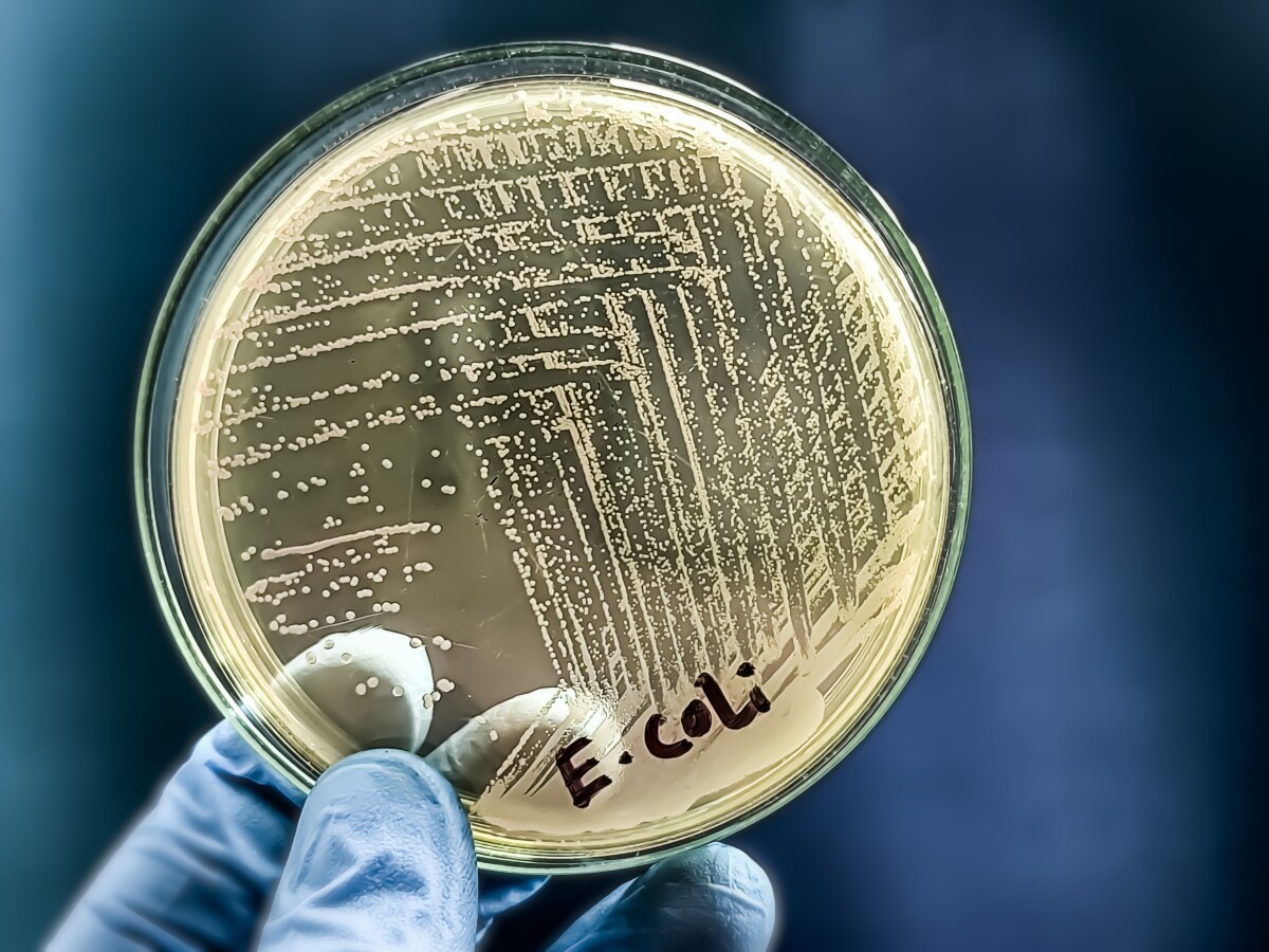 E. coli