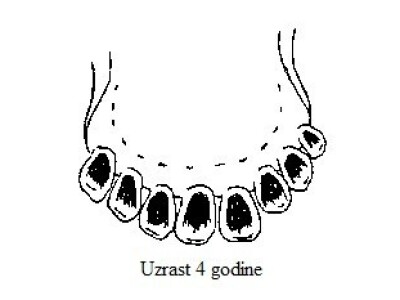 Uzrast oko 4 godine (svi mlečni zubi promenjeni) Uzrast oko 4 godine (svi mlečni zubi promenjeni)