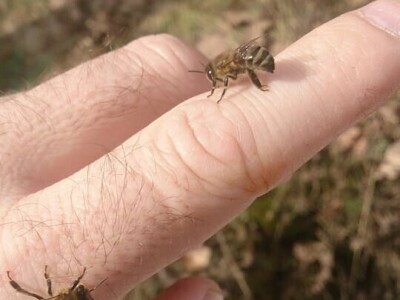Almir Hujdur: Pčelinjim ubodima se borim protiv multiple skleroze Almir Hujdur: Pčelinjim ubodima se borim protiv multiple skleroze