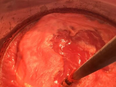 Cijela porodica zaljubljena u šipak, promijenio im je život na pozitivno