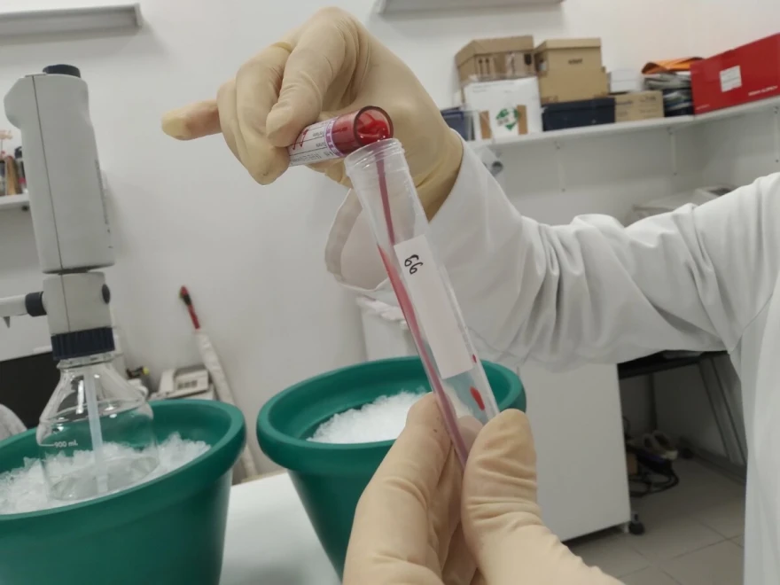 laboratorant drži epruvetu