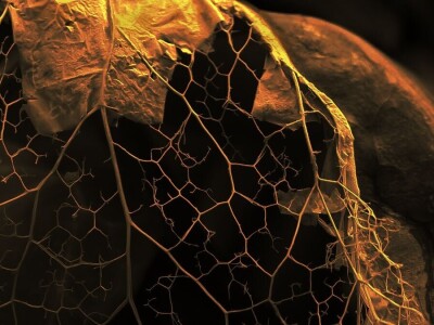 Šijanska šuma Pula