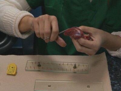 Trihineloza je neizlečiva