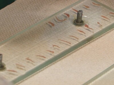 Trihineloza je neizlečiva