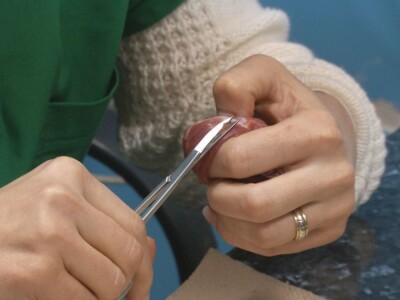 Trihineloza je neizlečiva