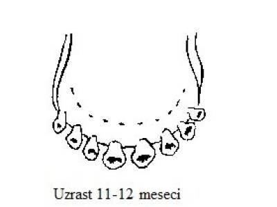 Uzrast 11-12 meseci (mlečni zubi) Uzrast 11-12 meseci (mlečni zubi)