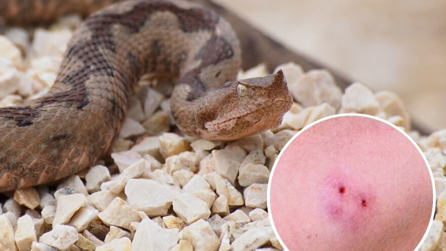 Kako izgledaju zmije otrovnice i šta ako dođe do ugriza?