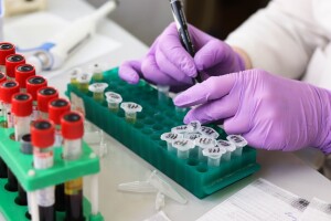 Presumjeren 21 milion KM za nabavku medicinske opreme