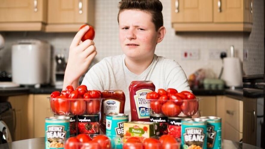 Hipnozom se riješio ovisnosti o - paradajzu!