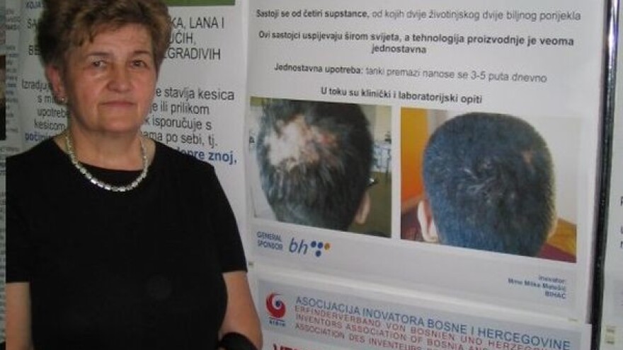 Kad zakaže medicina, pomažu Milkini preparati