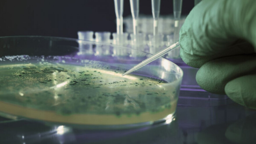 Salmonelom iz paste od sezama zaraženo 47 osoba