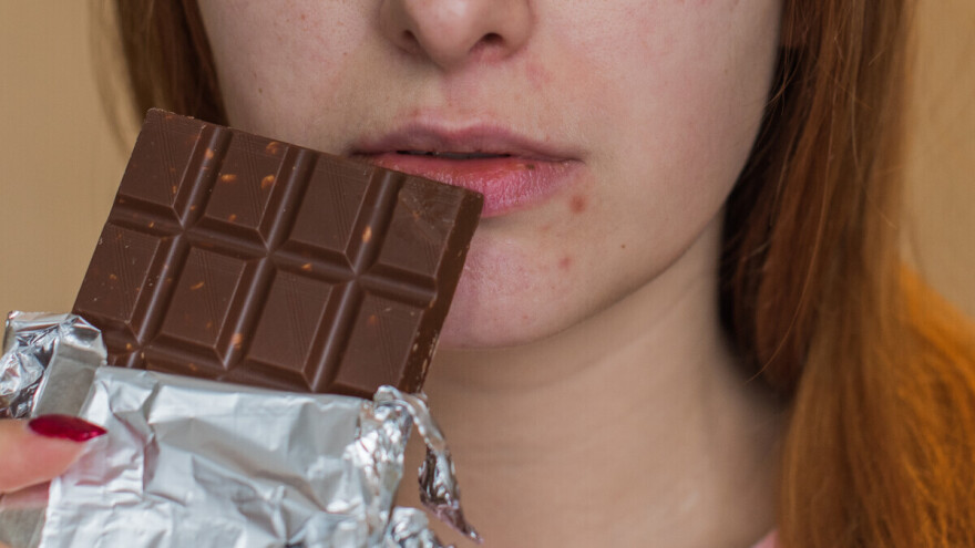 Je li čokolada krivac za pojavu akni?