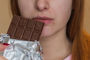 Je li čokolada krivac za pojavu akni?
