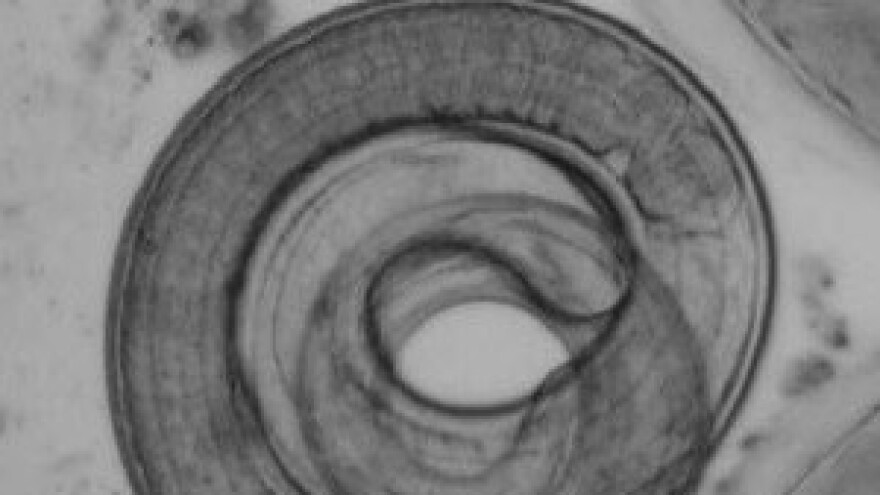 Sa svinjokoljom dolazi i trihinela